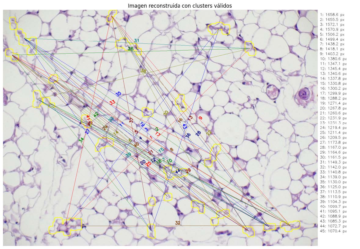 Foto del proyecto: Automatización del Análisis Morfológico de Adipocitos en Tejido Mamario Tumoral